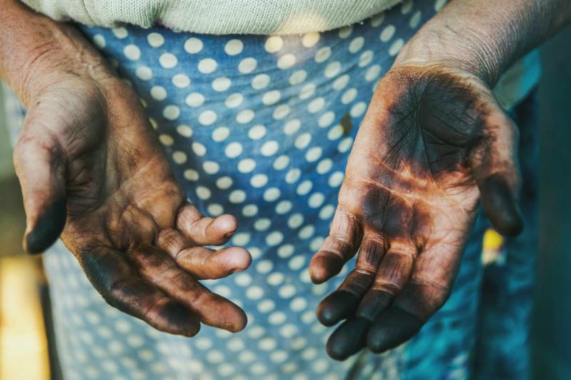 Stains on the hands of oily