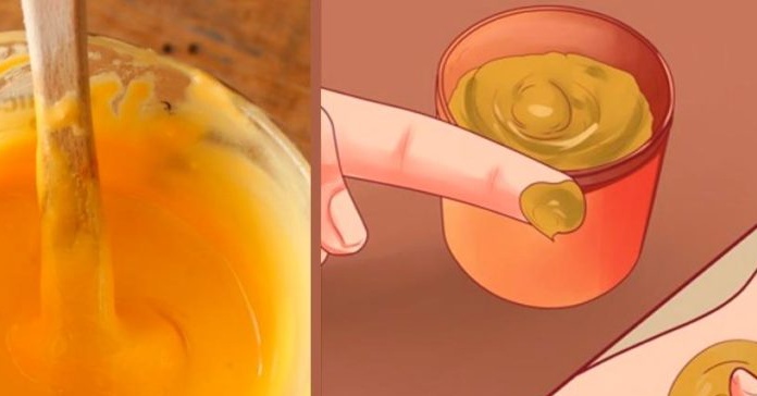 Turmeric